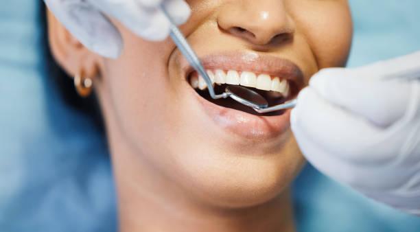 Best Broken or Cracked Tooth Emergency Dentist in Cloverleaf, TX