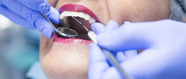 Best Emergency Dental Care for Abscessed Tooth in Cloverleaf, TX
